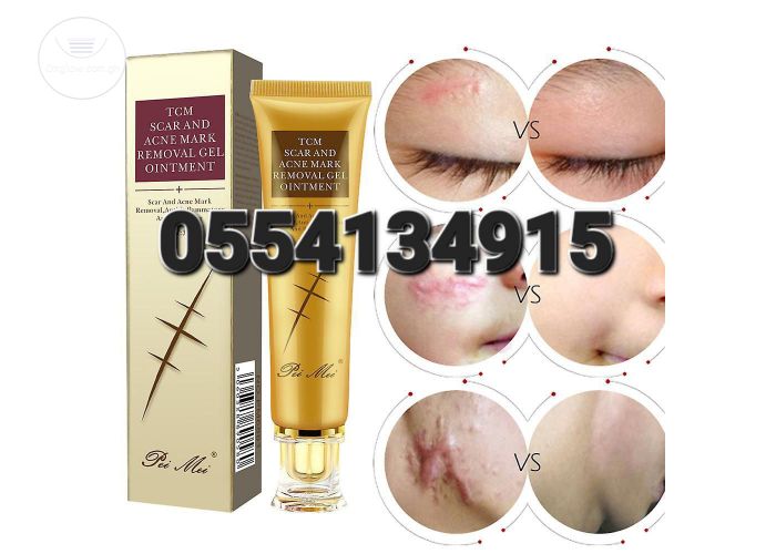 Scar Acne Removal Gel